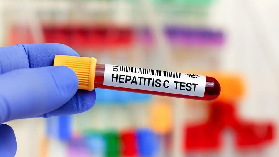 Circa il 70% delle persone infette non sa di esserlo