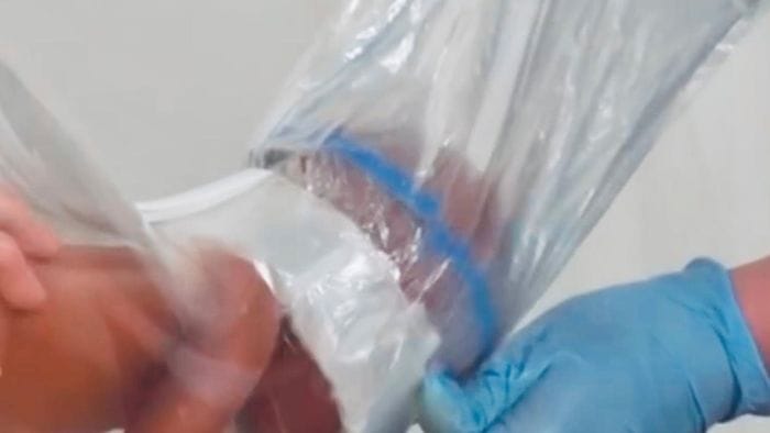 Una simulazione nell’utilizzo del dispositivo Odon