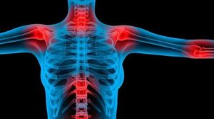 L’associazione dei malati di fibromialgia si presenta a Biella